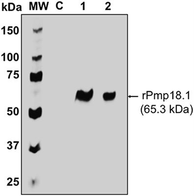 Chlamydia abortus Pmp18.1 Induces IL-1β Secretion by TLR4 Activation through the MyD88, NF-κB, and Caspase-1 Signaling Pathways